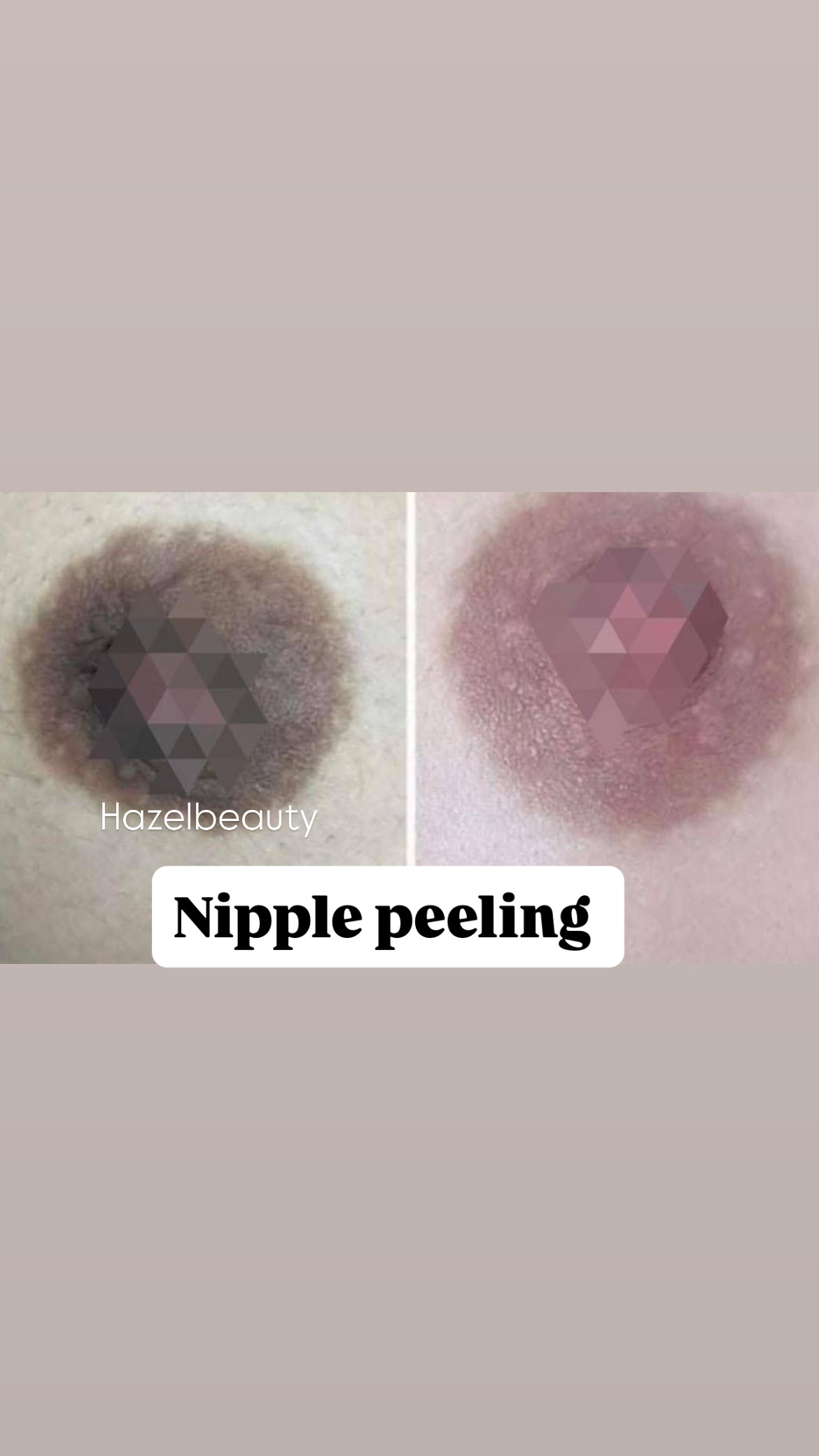 Body Treatment