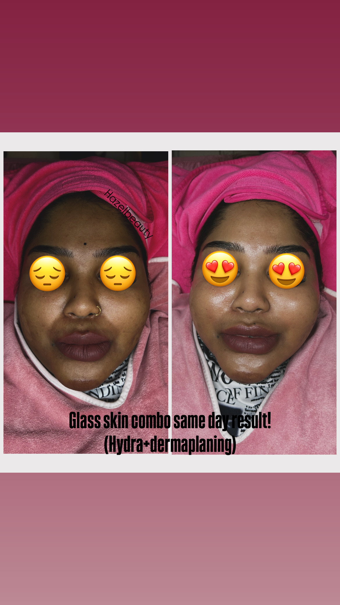 Facial Treatment