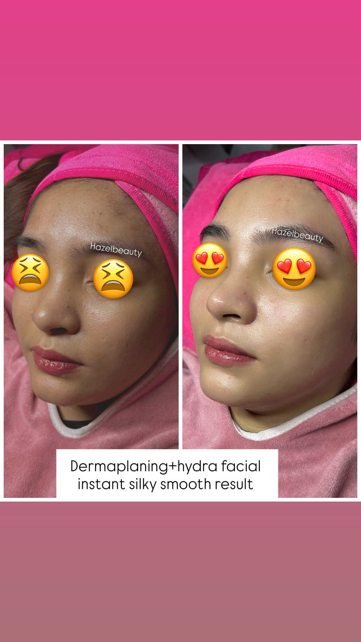 Facial Treatment