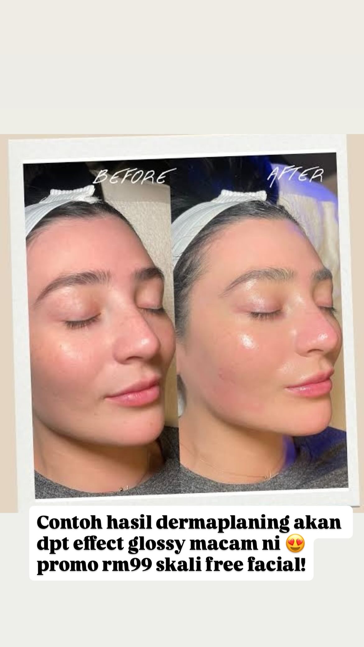 Facial Treatment