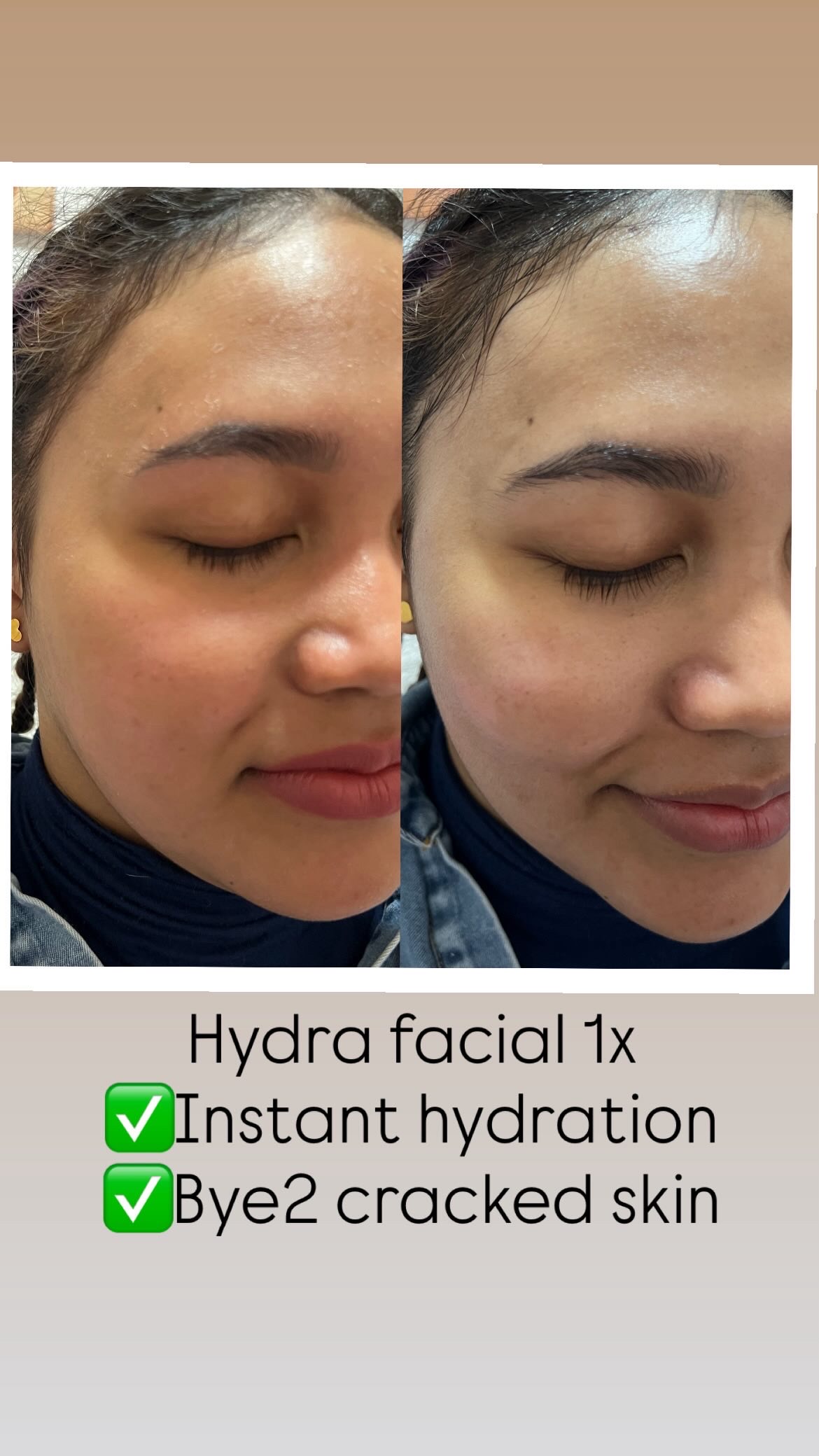 Facial Treatment