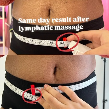 slimming / Lymphatic Massage