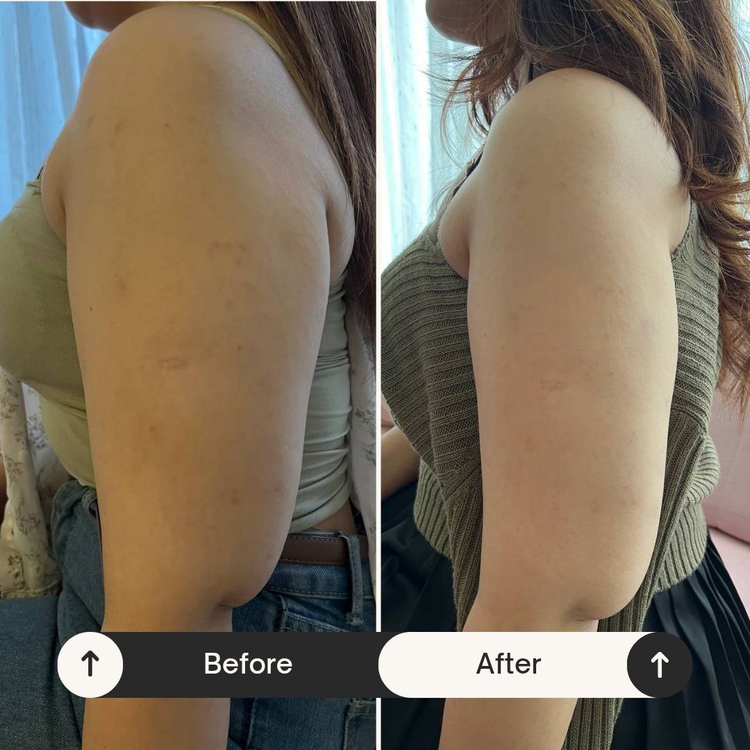 slimming / Lymphatic Massage