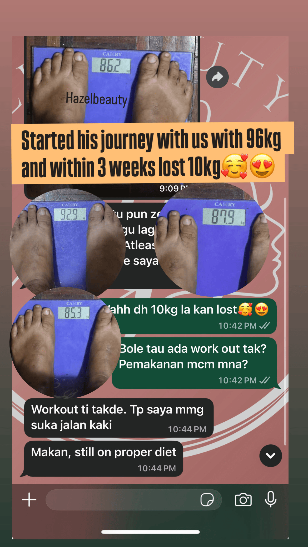 Slimming Treatment Before & After