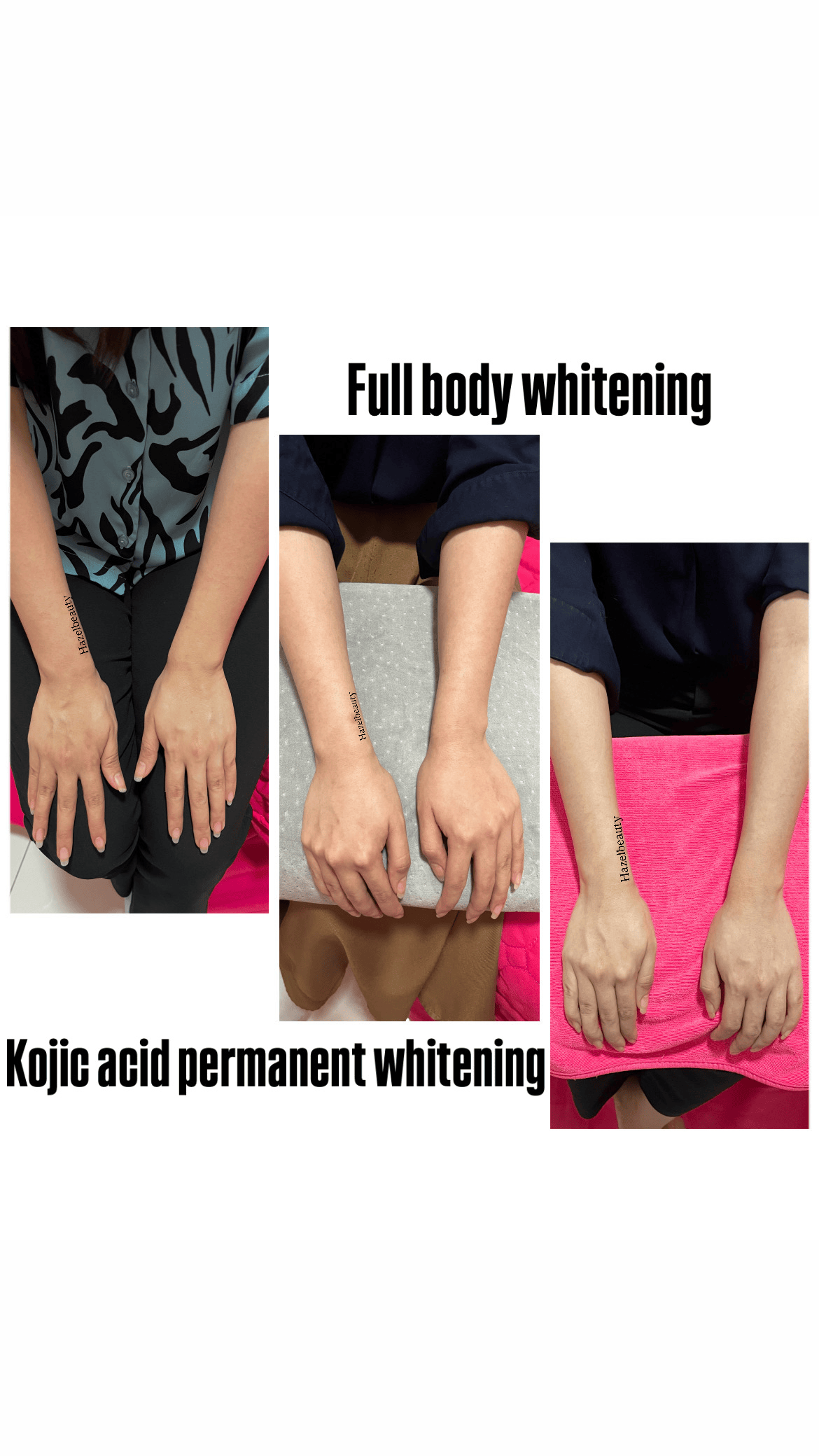 Whitening Treatment Before & After